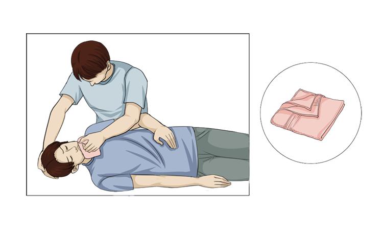 癫痫17.jpg