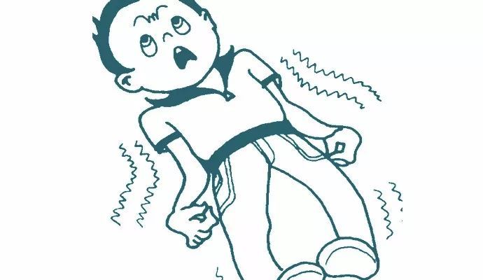 癫痫46.jpg