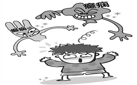 癫痫18.jpg